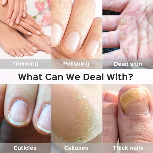 COSLUS Professional Manicure Pedicure Kit: 5 in 1 Electric Nail File Set Toenail Grinder, 5 Speed Cordless Nail Drill for Thick Nail Toenail Cuticle, Hand Feet Trimmer Buffer for Women Men Baby Pets