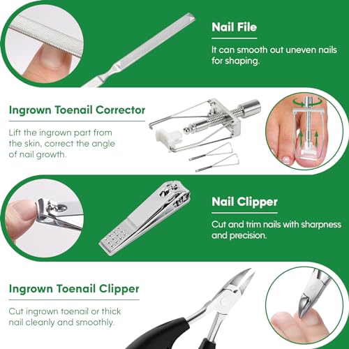 Ingrown Toenail Tools Kit, Ingrown Toenail Treatment, Stainless Steel Ingrown Toenail Removal Kit, Ingrown Toenail Corrector, Corrector Patch, Toenail Clipper, Nail File Lifter Pedicure Tool