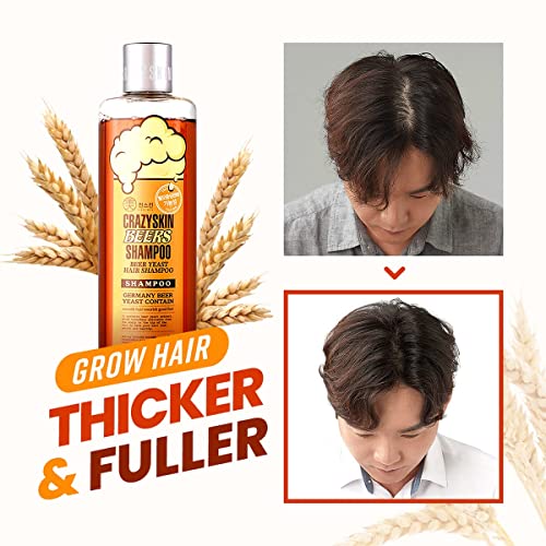 CRAZY SKIN German Beers Shampoo - 20.30 fl oz(300ml) X 2set, BIOTIN for hair loss, Rich with Beer Yeast for Regrowth and Thickening, Sulfate/Chemical free, Suitable for all hair types