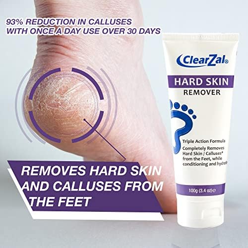 ClearZal Foot Cream For Hard Skin, Helps Calluses and Corn Removal While Leaving Soft Smooth Skin, Hydrating and Conditioning Triple Action Formula With Aloe Vera, 3.4 Ounce Tube