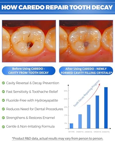 Cavity Reversal Hydroxyapatite Toothpaste for Adults, Cavity Tooth Filler as Home Cavity Repair, Fluoride Free Reverse Cavities Treatment for Tooth Decay Repair, Remineralizing Repair 3.52OZ