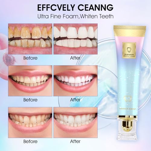 2Pcs Niacinamid Toothpast, Niacinamide Intensive Whitening Toothpaste, Complete Care Toothpaste, Repair and Protect Teeth, Remove Tooth Stains