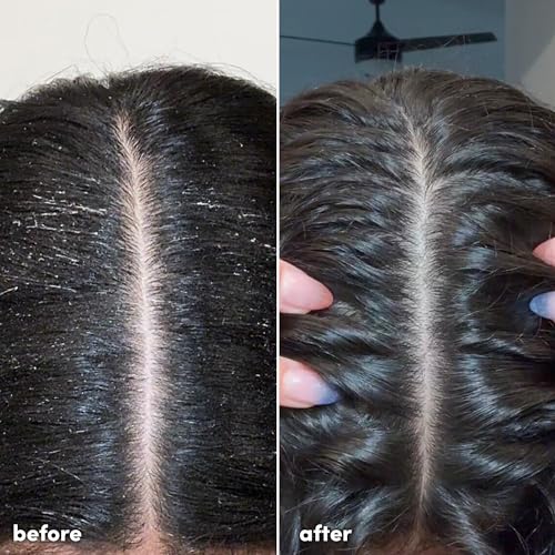 Coco and Eve Clarifying Detox Shampoo. Remove Hard Water & Product Build Up. With Hibiscus Cider Vinegar to Detox Scalp. Color Safe & Non-Stripping. (280 ml)