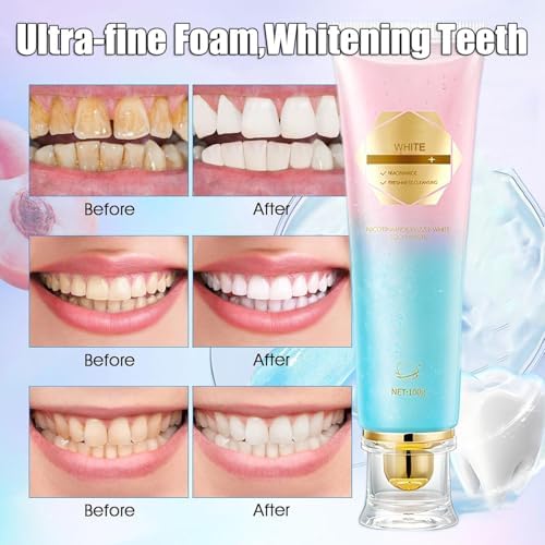 2 - Pack Niacinamide Whitening Toothpaste - Whitens Teeth, Strengthens Enamel, Removes Stains - for Sensitive Teeth (2 x 100g)