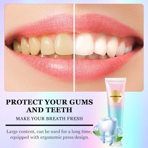 2Pcs Acssart Radiant Niacinamide Intensive Whitening Toothpaste, Niacinamide White Toothpastes, Remove Tooth Stains, Fresh Breath