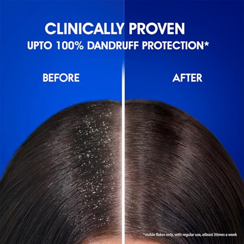 Head & Shoulders Smooth And Silky Shampoo, 1L