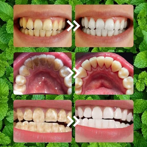2PCS Teeth Restoration Mineral Powder,Mineral Tooth Powder,Teeth Whitening Mineral Powder, Effective in Strengthening Teeth and Gums, Dental Restoration Mineral Powder, Fresh Breath for Daily Use 50g