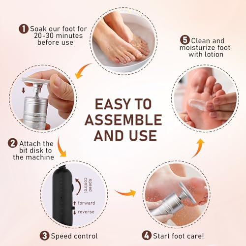 Kredioo Electric Foot Callus Remover Nano Glass Foot File German Technology Grinding Sanding Pedicure Tool for Feet Sensitive Skin Safe Adjust Speed R/F Direction Remove Thick Toe Nails