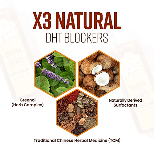 CRAZY SKIN German Beers Shampoo - 20.30 fl oz(300ml) X 2set, BIOTIN for hair loss, Rich with Beer Yeast for Regrowth and Thickening, Sulfate/Chemical free, Suitable for all hair types