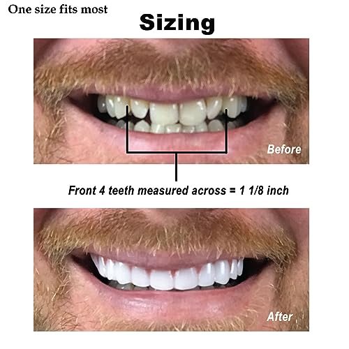 Instant Smile Comfort Fit Flex Natural Shade