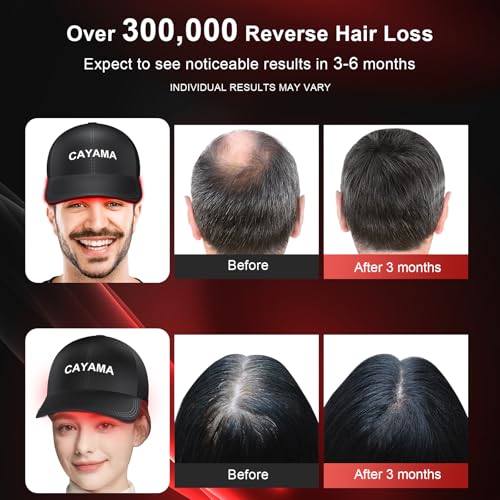 CAYAMA Laser Hair Growth Cap, 510 LEDs Red Light Cap for Fuller Looking Hair & Scalp Support for Men & Women