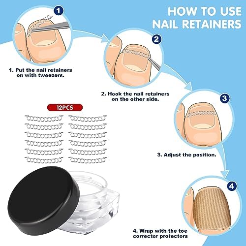 Ingrown Toenail Removal Kit Includes Ingrown Toenail Corrector, Tweezer, 50pcs Nail Patches,12 Nail Retainer,10 Toenail Corrector Strips